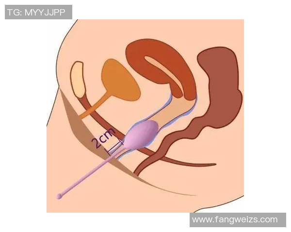 阴道收缩哑铃的效果如何对女性健康的影响分析与探讨